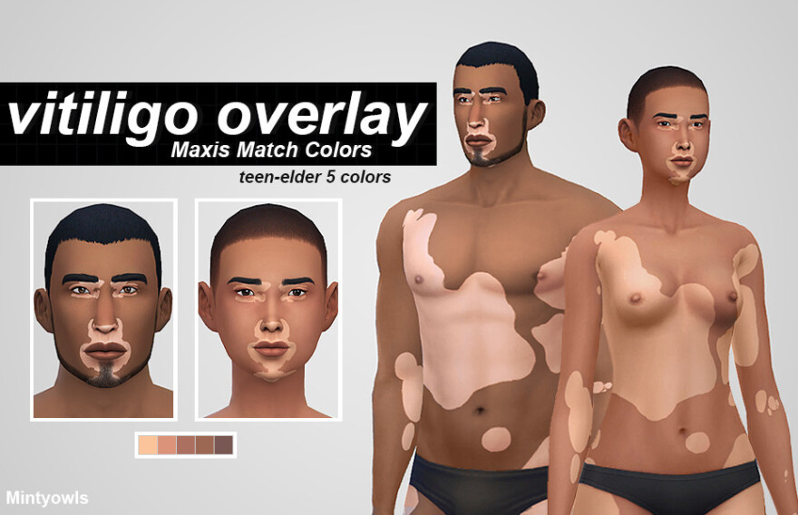 Vitiligo Overlay
