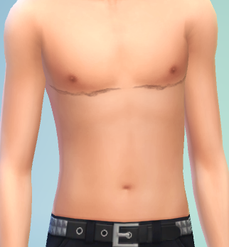 Top Surgery Scars For Transmasculinesims